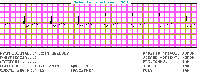 EKG wykresy z łyżek, Pierwsza Pomoc - c16-0.png